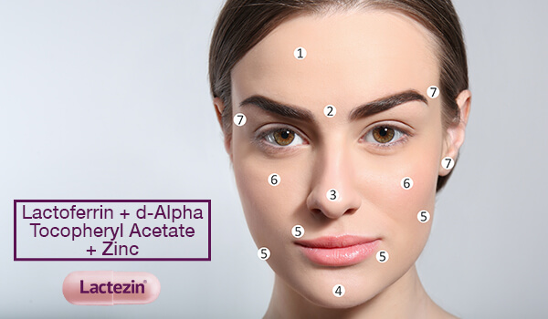 acne-face-map-understanding-pimples-and-their-locations-on-your-face