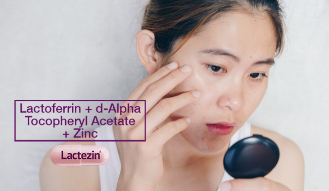 the-science-of-sebum-on-skin-and-how-it-leads-to-acne